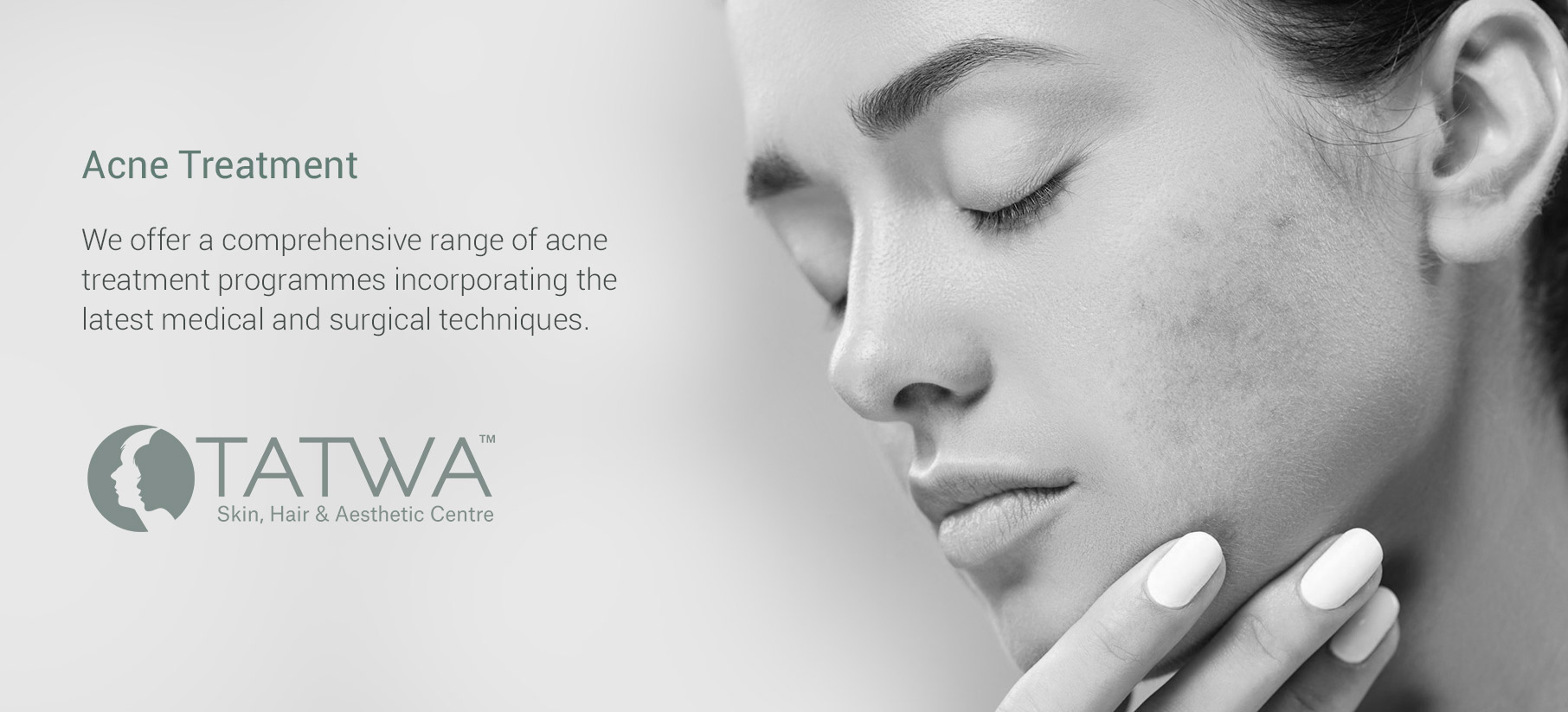 Acne-Treatment-in-Indore